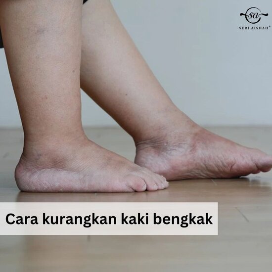 10 Cara Kurangkan Bengkak Kaki